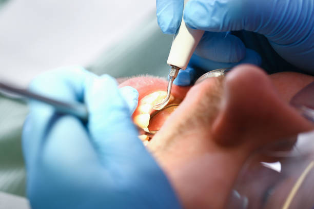 Best Emergency Gum Treatment in Tuckahoe, VA