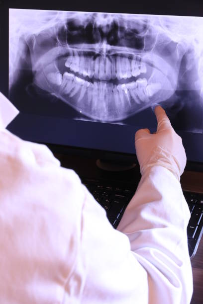 Best Emergency Dental Care for Broken or Chipped Teeth in Tuckahoe, VA